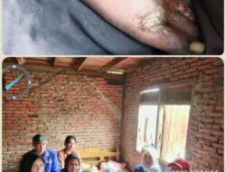 Diduga Jadi Korban KDRT, Ibu Muda Asal Sukau Lambar Babak Belur Dihajar Suaminya