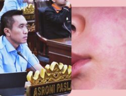 Kasus Campak Meningkat, Komisi IV DPRD Bandar Lampung Desak Pemerintah Jangan Lalai